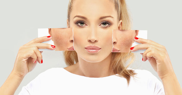 How Do Celebrities Lighten Their Skin Permanently?