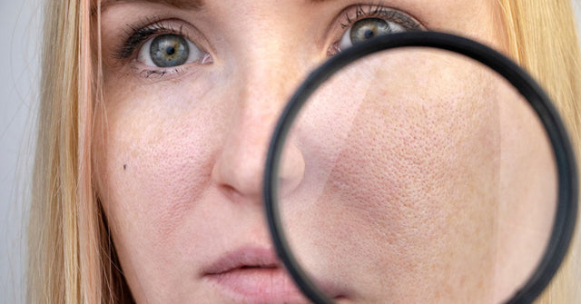 Clogged Pores - Prevention, Signs, Causes and Treatment