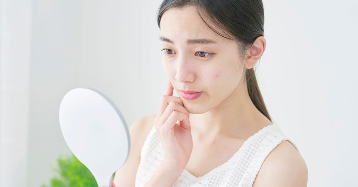 Dry Skin and Acne Can Dry Skin Make Acne Worse? Solvaderm