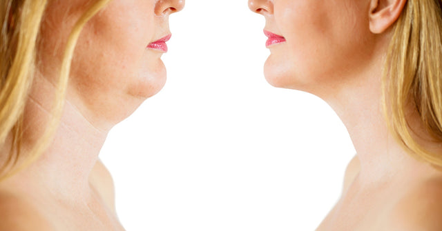 Before after review of Revivatone