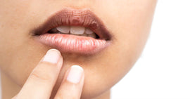 10 Causes of Dry Skin Around Your Mouth