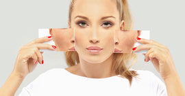 How Do Celebrities Lighten Their Skin Permanently?