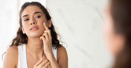 What Is Cheek Acne and How Can It Be Treated?