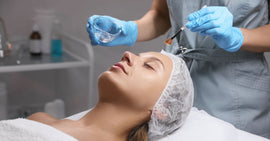 Chemical Peel for Hyperpigmentation: What You Need to Know