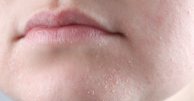 Dehydrated Skin Guide: Tips and Tricks for a Healthy Complexion