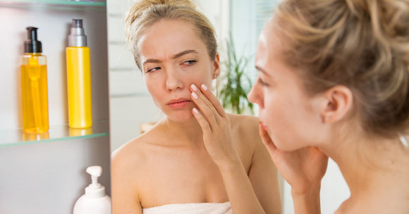 Managing Dry Skin Acne: Effective Skin Care Tips