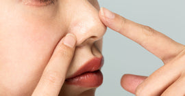 6 Successful Methods to Fix Dry Skin Around Nose