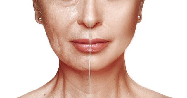 Age Brilliance Neck Cream Review vs. Stemnucell Review: Which Works?