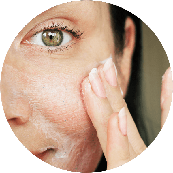 Solvaderm